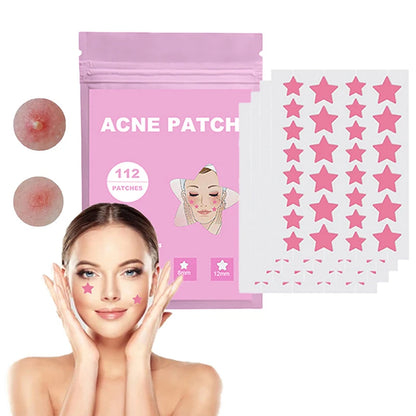 112 Pcs Star-Shaped Acne Pimple Patches - Colorful Hydrocolloid Skin Care Stickers for Spot Concealing & Fast Healing - Fun & Effective Acne Treatment