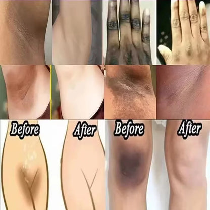 Intensive Whitening Cream for Sensitive Areas - Dark Skin Lightening & Bleaching Moisturizer for Underarms, Knees & Intimate Areas