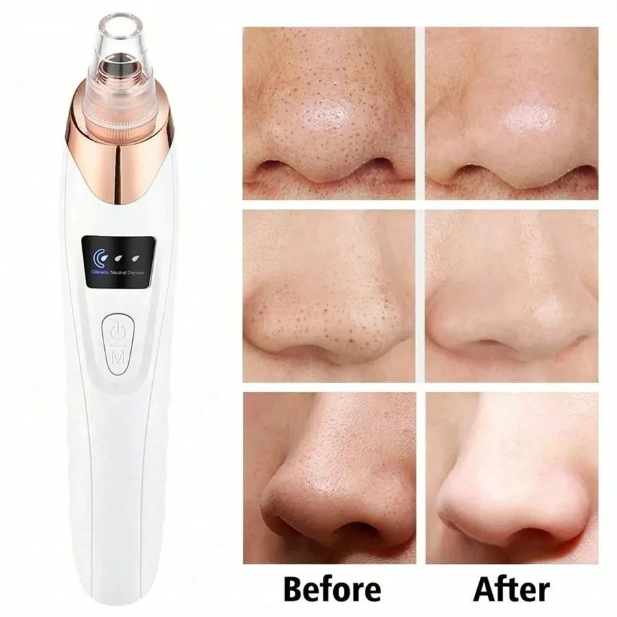 Professional Electric Blackhead Remover Vacuum - Pore Cleaner with 5 Suction Heads & USB Rechargeable Acne Pimple Extractor Kit