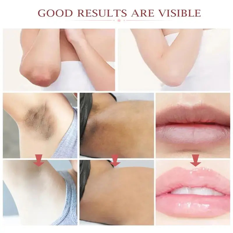 Intensive Whitening Cream for Sensitive Areas - Dark Skin Lightening & Bleaching Moisturizer for Underarms, Knees & Intimate Areas